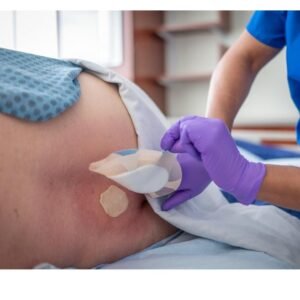 Bedsore Care