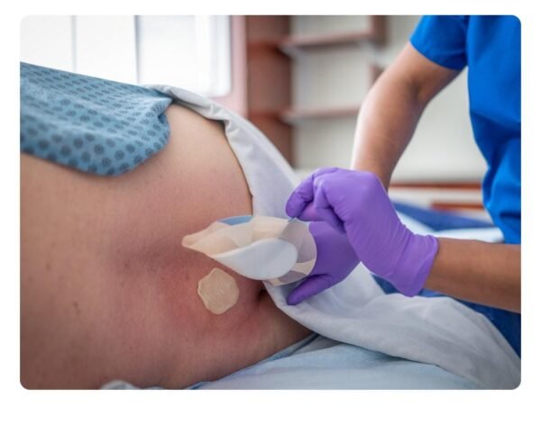 Bedsore Care