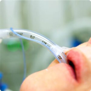 ET (Endotracheal Tube) Care